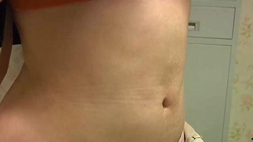 肚子吸脂视频全过程,肚子吸脂手术全过程