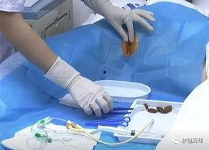 泌尿系统视频,功能与疾病防治全解析