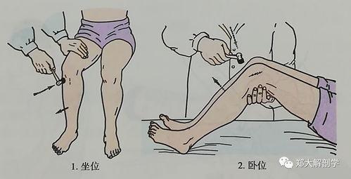 跟腱反射检查方法视频,跟腱反射检查方法视频详解
